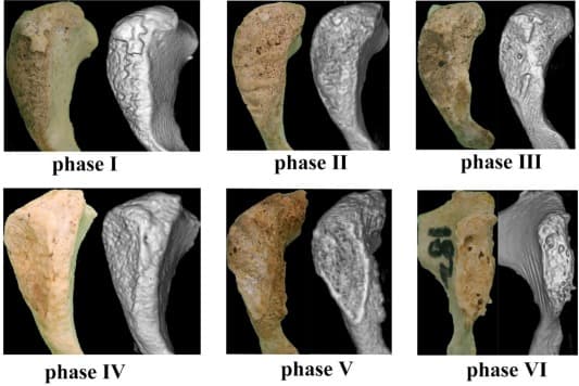 Suchey-Brooks method